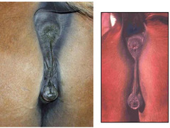 <p>What abnormality is shown?</p>