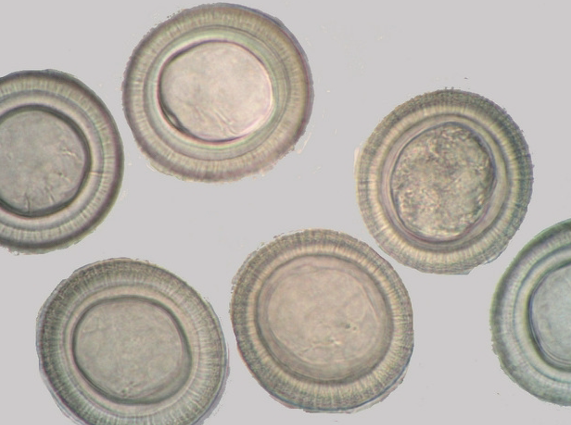 <p>What parasitic worm is this?</p>