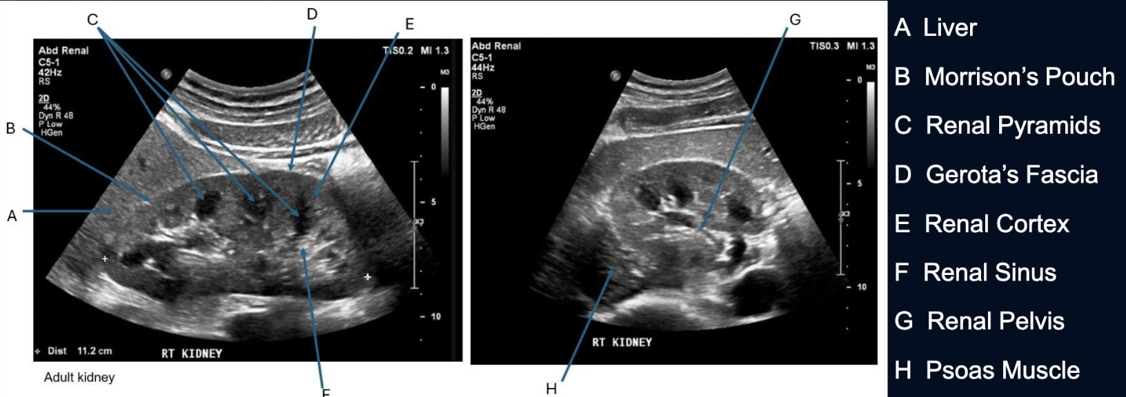 <ul><li><p>Long then Trv</p></li></ul><p></p>