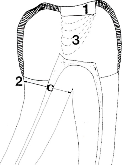 <p>The first step to creating an access for a mandibular molar is to prepare the cavosurface outline and cut through enamel into dentin. How should you find the roots?</p>
