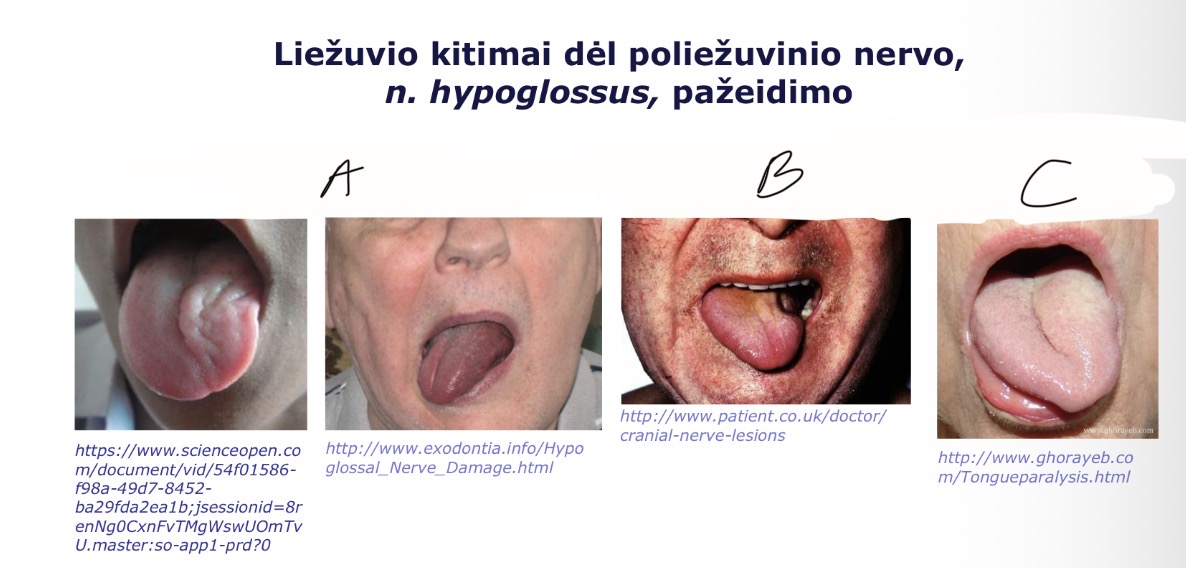 <p>A</p>