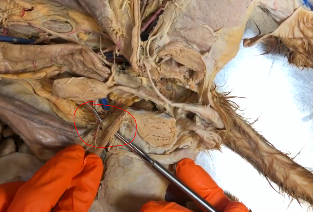 <p>What is this opening in the abdominal wall</p>
