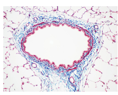 <p>What is Trichrome staining (what colour is collagen fibers, nuclei and cytoplasm?)</p>