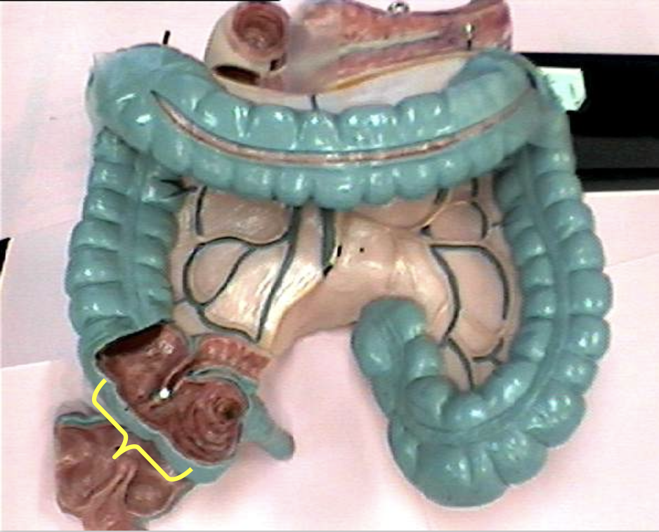 <p>Identify the organ.</p>