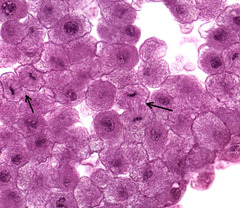 <p>What phase of mitosis is indicative of the cell at the arrow?</p>