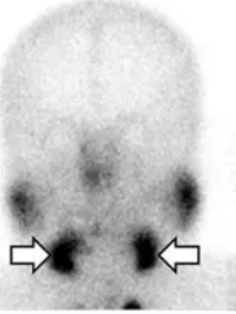<p>what could this salivary test indicate </p>