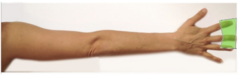 <p>median nerve supplies the:</p><p>-palm of hand</p><p>-ventral region of thumb</p><p>-distal portions of index finger, middle finger, & the medial half of the ring finger</p>