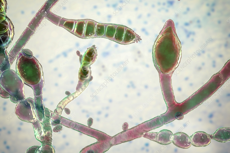 <p>Microsproum audouinii</p>