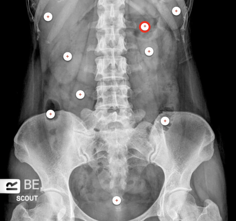 <p>what structure is the red circle labeling? </p>