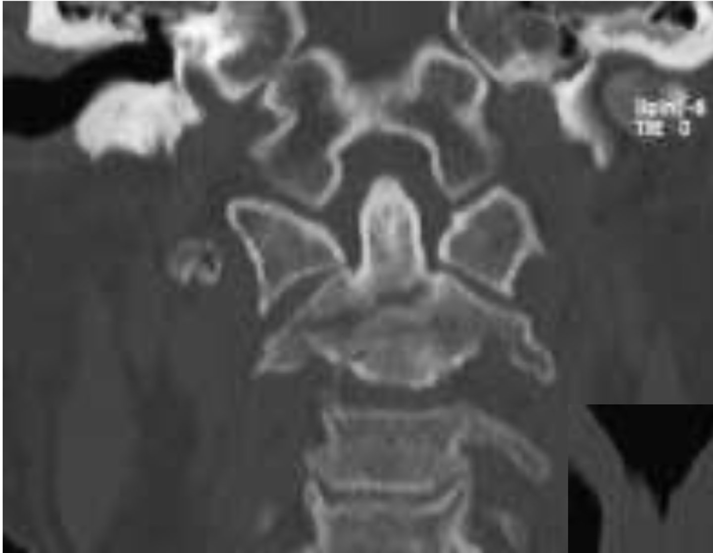 <p>What is the diagnosis?</p>