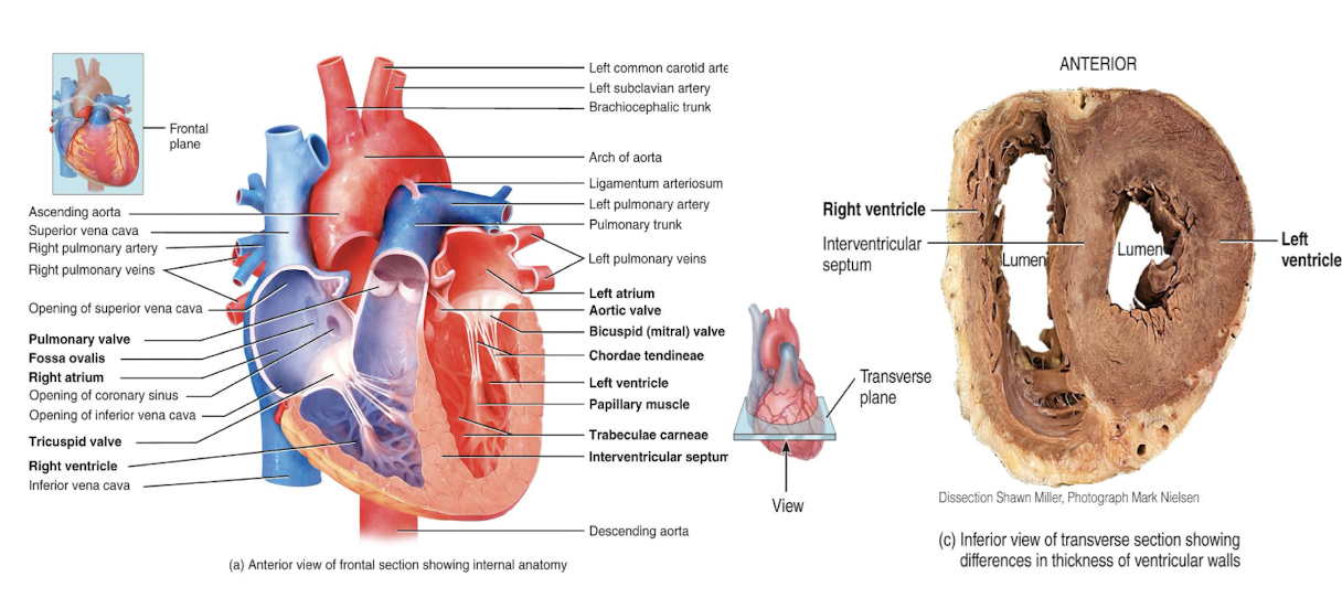 <p>thicker than that of the right ventricle since it pumps blood throughout entire body, while right only does for lungs</p>