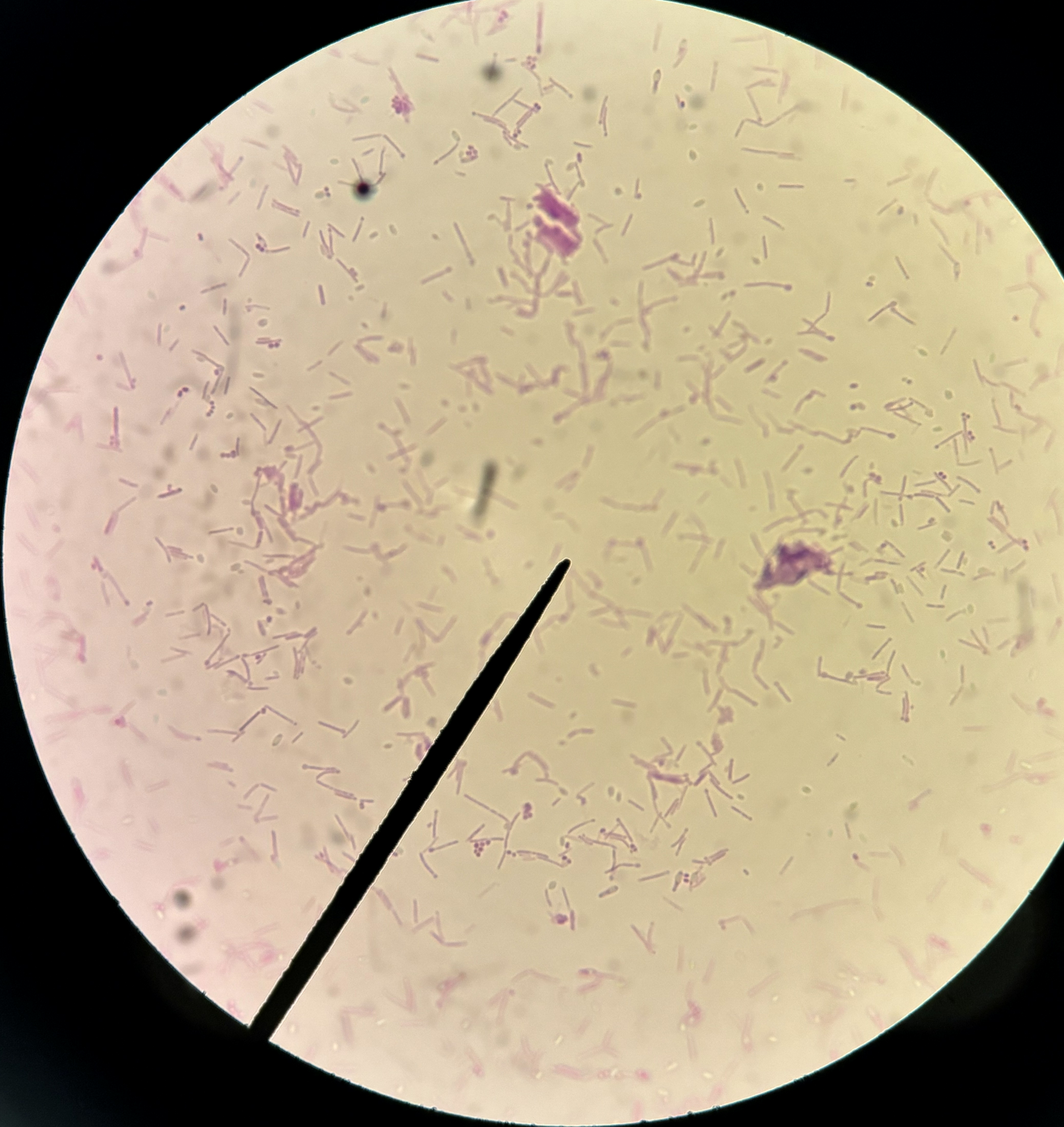 <p>What type of toxin does Clostridium release</p>