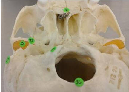<p>foramen magnum </p>
