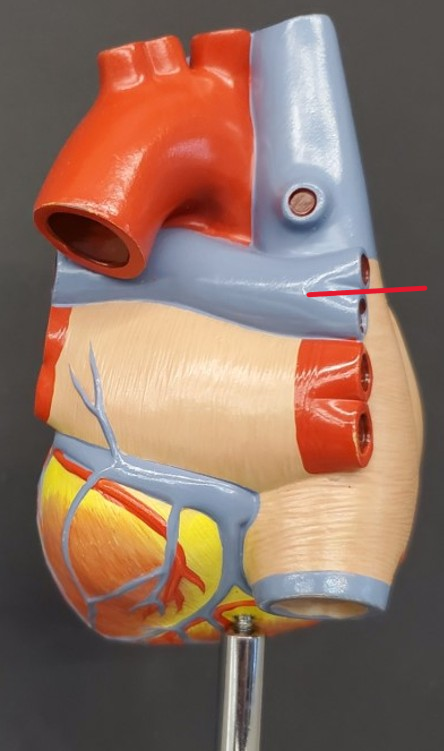 <p>Name the artery</p>