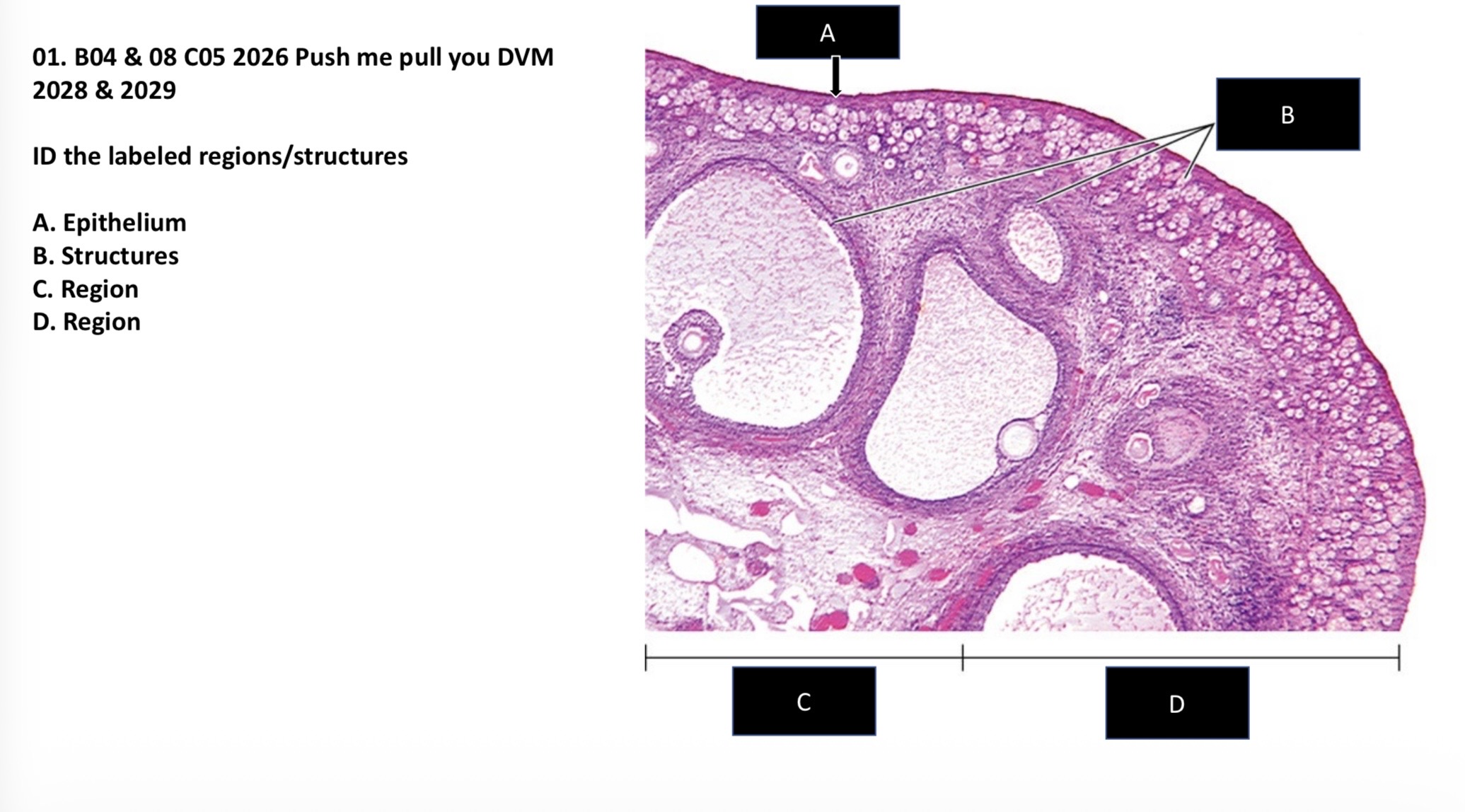 <p>A. Germinal/Simple cuboidal </p><p>B. Follicles </p><p>C. Medulla</p><p>D. Cortex </p>