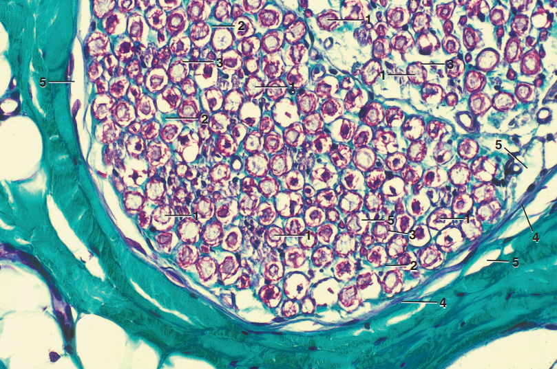 <p>Part and Stain?</p>