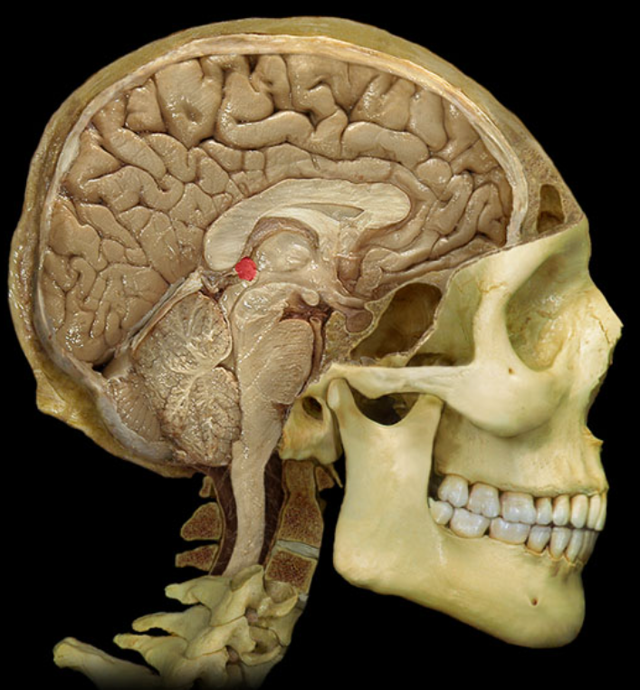 term image