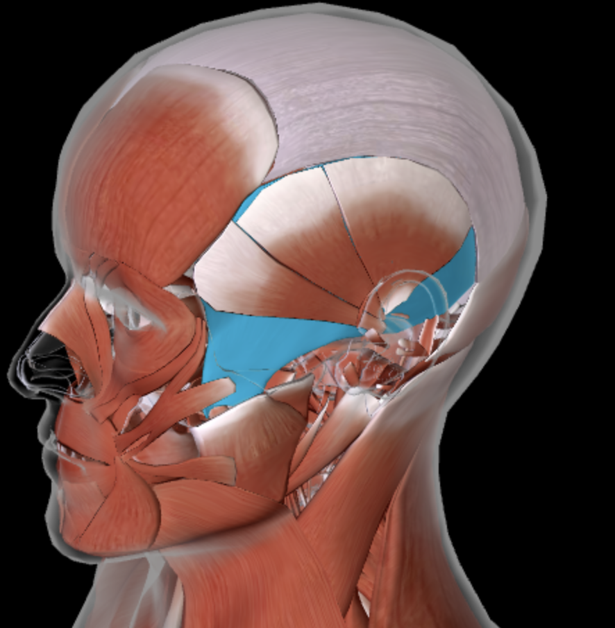 term image