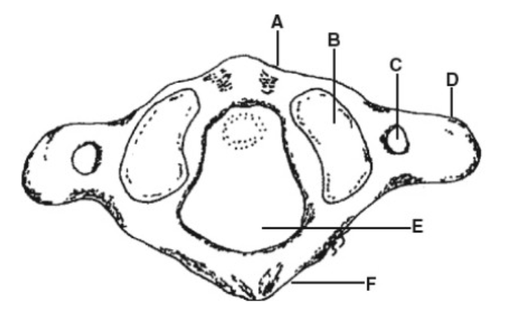 <p>C</p>