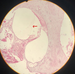 <p>what is the histological classification of the structure indicated (by the red arrow) and what is it's anatomical name</p>