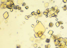 <ul><li><p>diamond or rhomboid most common shape</p></li><li><p>yellow or yellow-brown</p></li><li><p>not common except in dalmatians </p></li></ul><p></p>