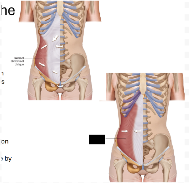 <p>What muscle is this?</p>