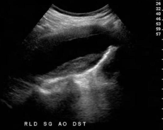 <p>what statement correctly describes this image of the aorta?</p>