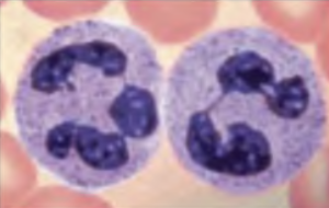 <p>What blood cell is this?</p>