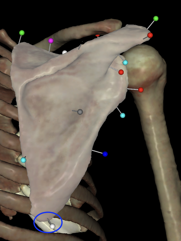 <p>What is the white tag on the<strong> right </strong>scapula?</p>