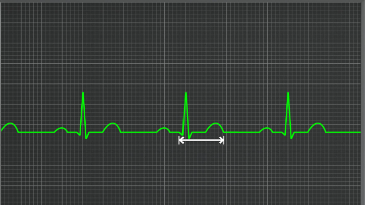 <p>What interval is this</p>