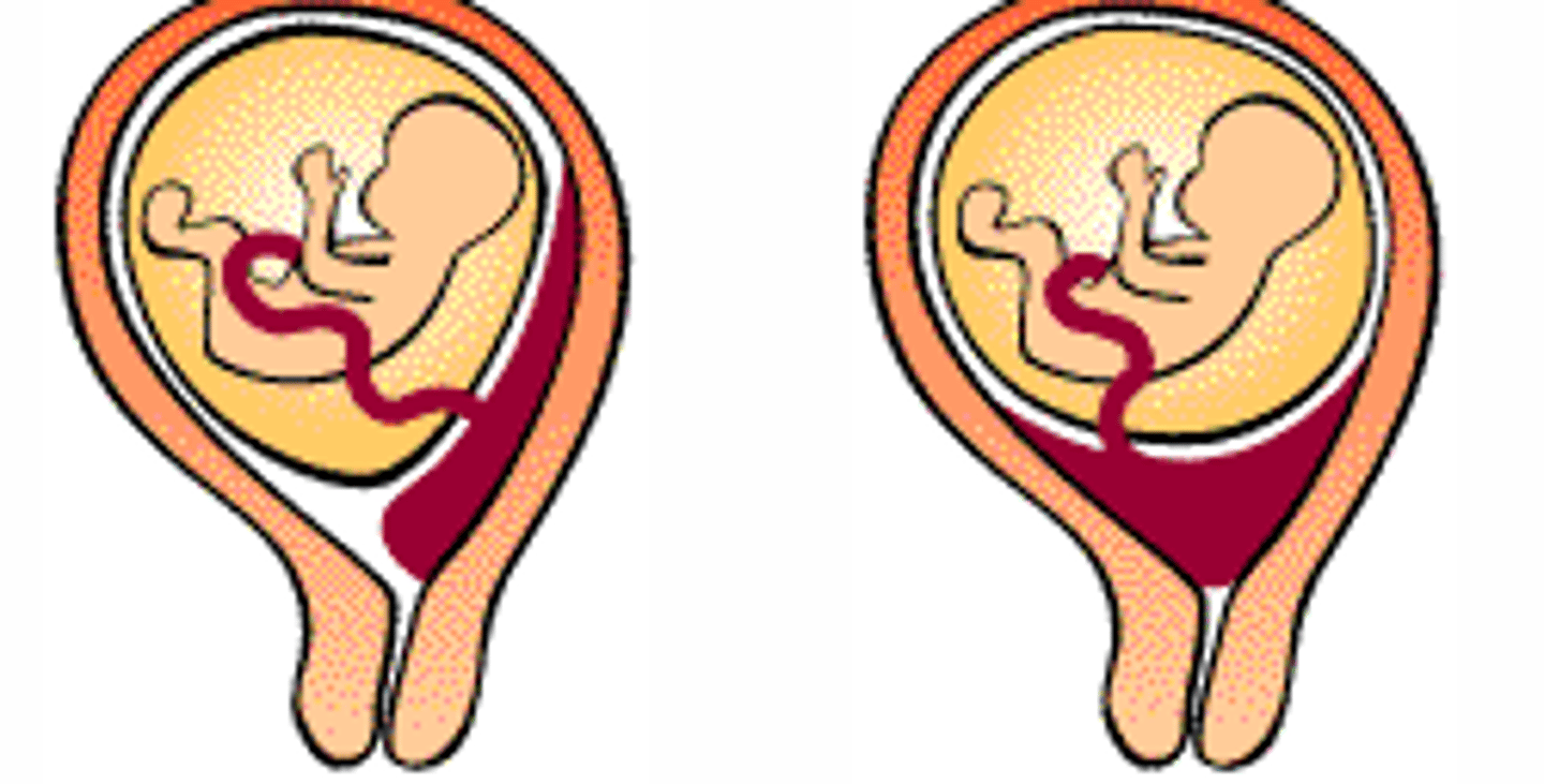 <p>Organ facilitating nutrient, gas, and waste exchange between mother and embryo/fetus.</p>