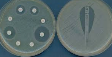 <p>Definición de antibiograma </p>