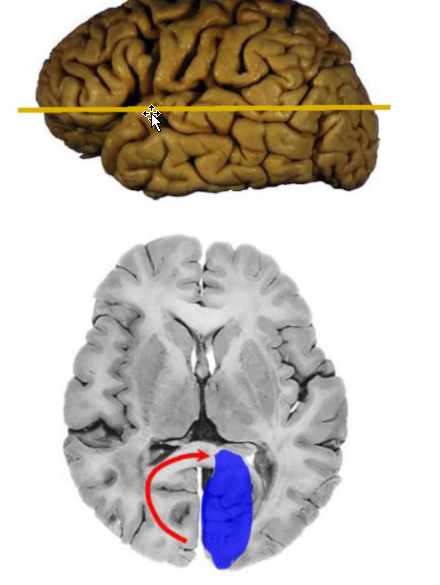 term image