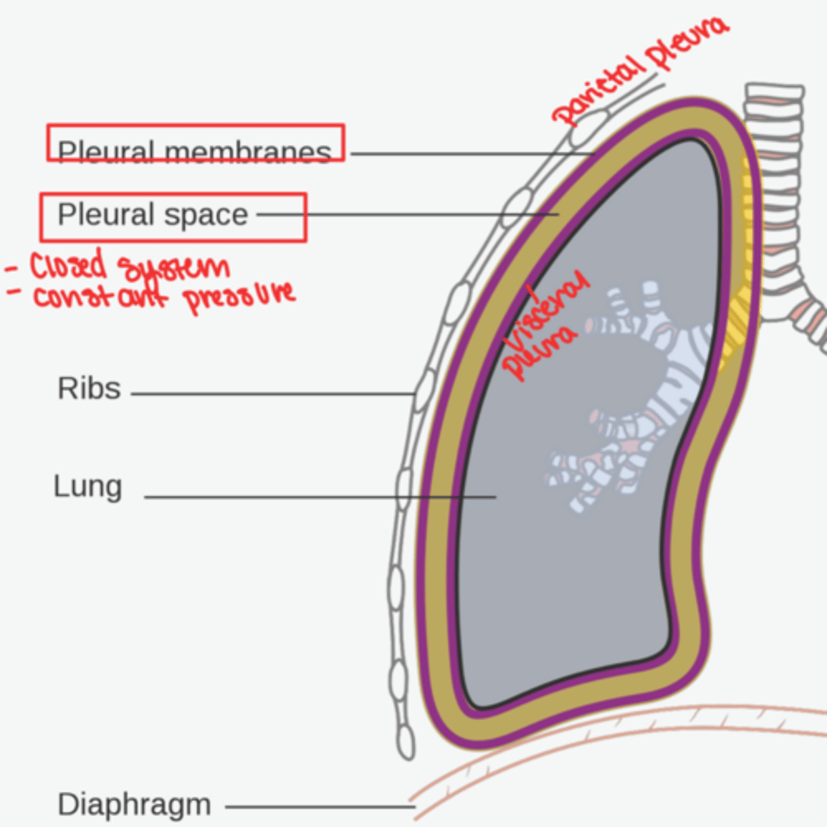 <p>used when lung collapses away from chest wall</p><p>large diameter tube inserted into pleural space to drain air or fluid, allowing lung to re-inflate</p>