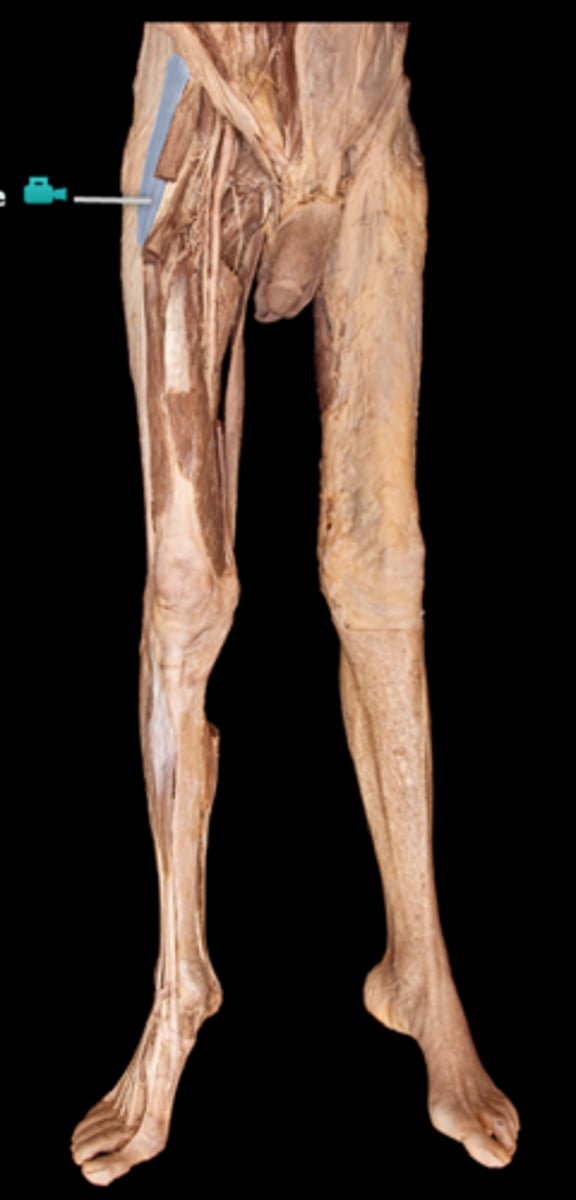 <p>What muscle is this?</p>