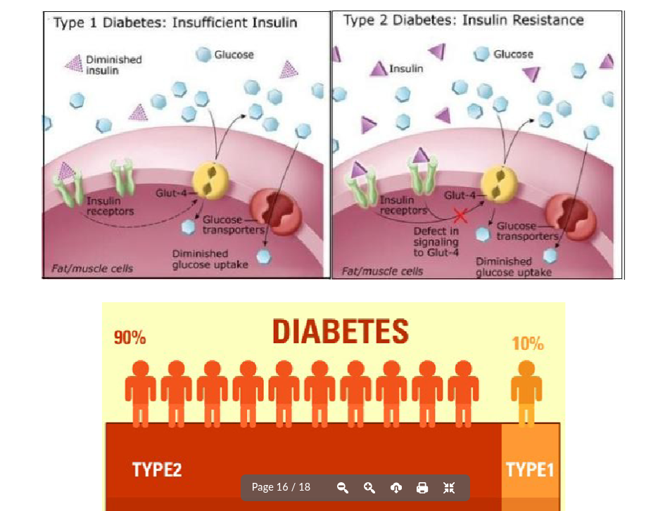 <ul><li><p>different types of diabetes based on the reason for the failure of insulin to regulate blood sugar</p></li></ul><p></p><ul><li><p>type 1 (aka juvenile diabetes)</p></li><li><p>type 2</p></li><li><p>gestational diabetes</p></li></ul><p></p>