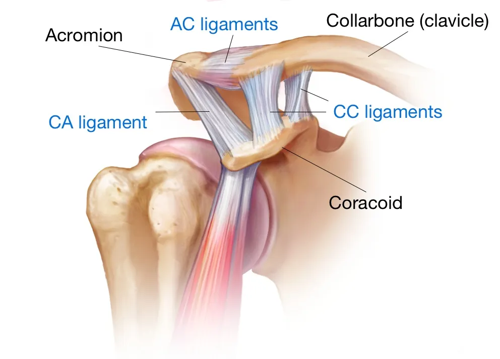 <p>planar joint </p><p>articulation between acromion process and clavicle</p><p>ligaments: </p><ul><li><p>acromioclavicular</p></li><li><p>coracoacromial</p></li><li><p>coracoclavicular </p><ul><li><p>tapezoid (anterior and lateral bands0</p></li><li><p>conoid</p></li></ul></li></ul><p>little bit more mobility than SC joint</p><p>anterior and posterior movement during protraction and retraction</p>