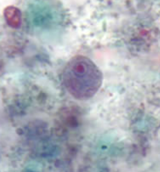 <ol><li><p>Endolimax nana</p></li><li><p>Trophozoite</p></li></ol><p></p>