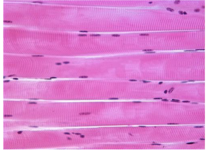 <p>Which muscle type is multinucleated, pulls on bones, and can function voluntarily or myogenically?</p>