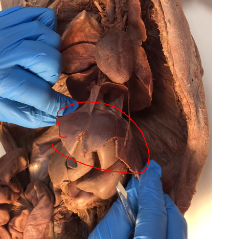 <p>What is this structure</p>