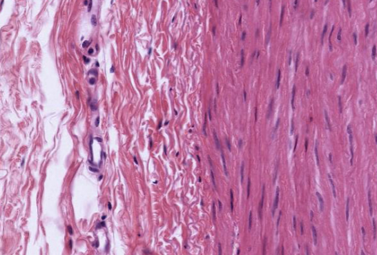 <ol><li><p>Sickle Cell Anemia</p></li><li><p>Atherosclerosis</p></li><li><p>Adenocarcinoma of Kidney</p></li><li><p>Osteogenic Sarcoma of Bone</p></li><li><p>Tattoo in Human Skin</p></li><li><p>Neurilemmoma</p></li><li><p>Anthracosis of the Lung</p></li><li><p>Basal Cell Carcinoma</p></li><li><p>Lung</p></li><li><p>Skeletal</p></li><li><p>Kidney</p></li><li><p>Neuron</p></li><li><p>Skin</p></li><li><p>Blood</p></li><li><p>Bone</p></li><li><p>Aorta</p></li></ol><p></p>