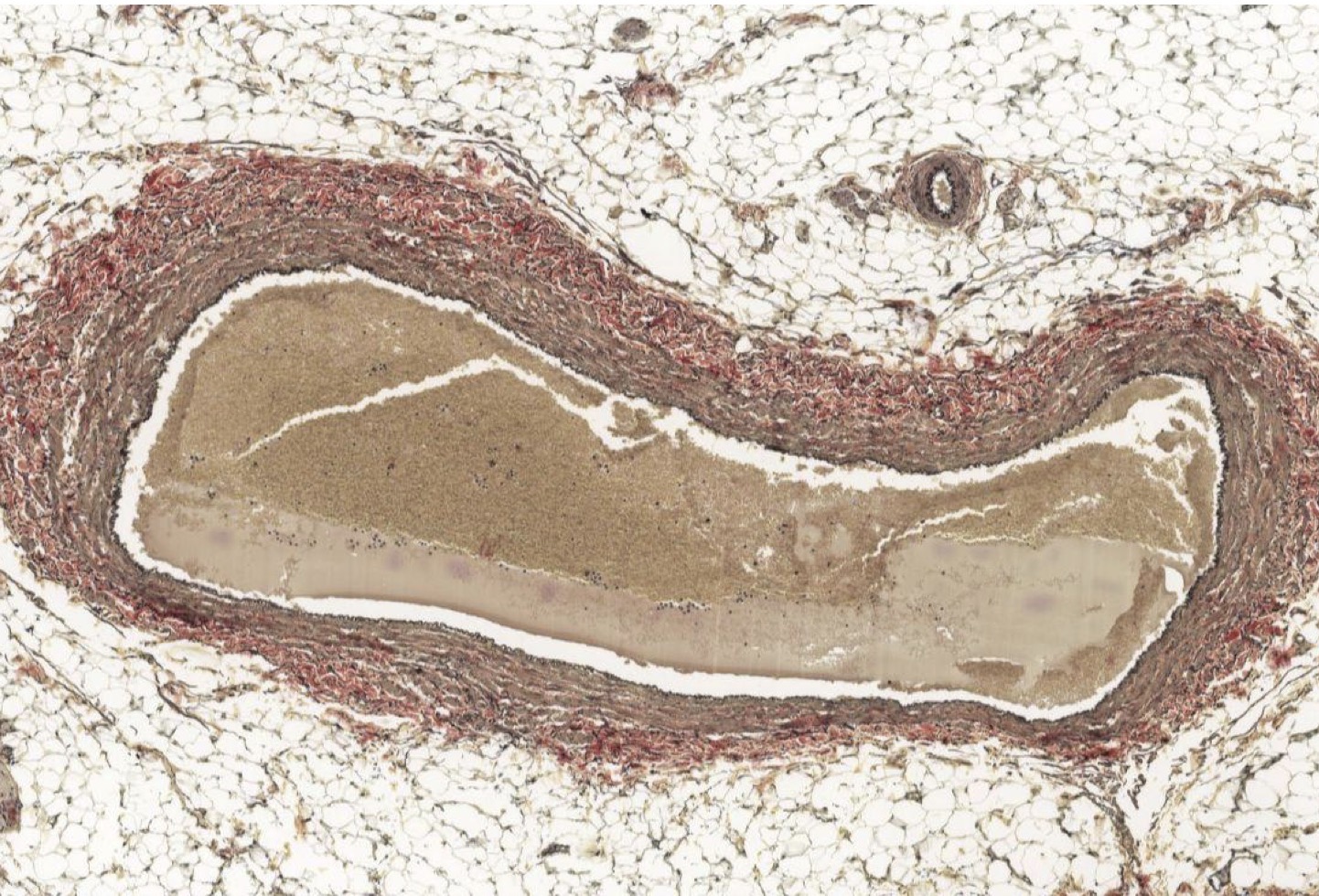 <p>Identify the Vessel and the Layer pictured</p>