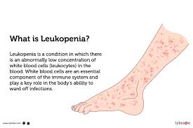 <p>What is leukopenia?</p>