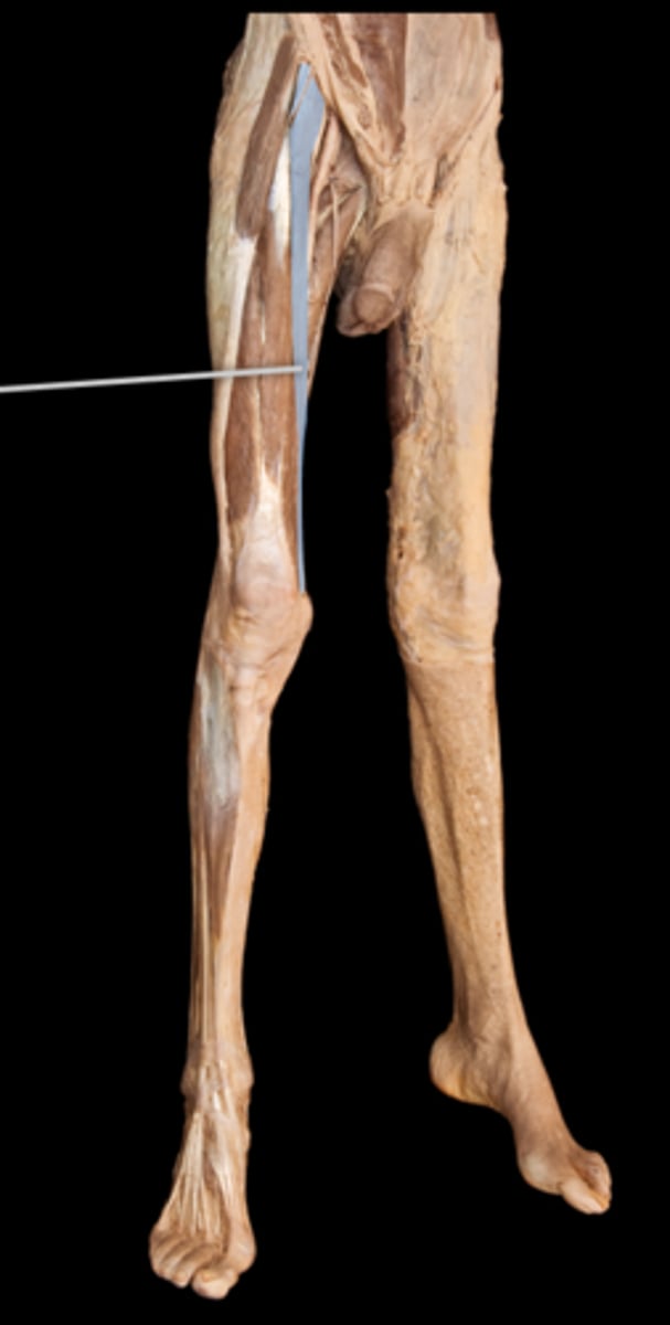 <p>What muscle is this?</p>