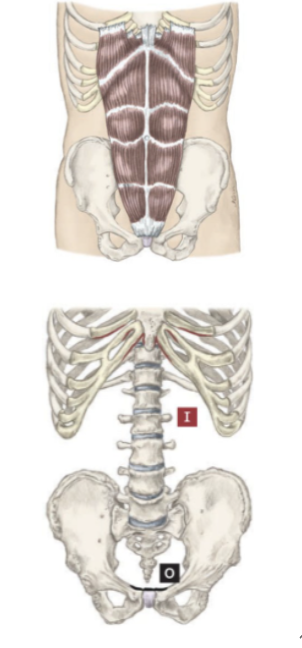 <p>What muscle is this?</p>