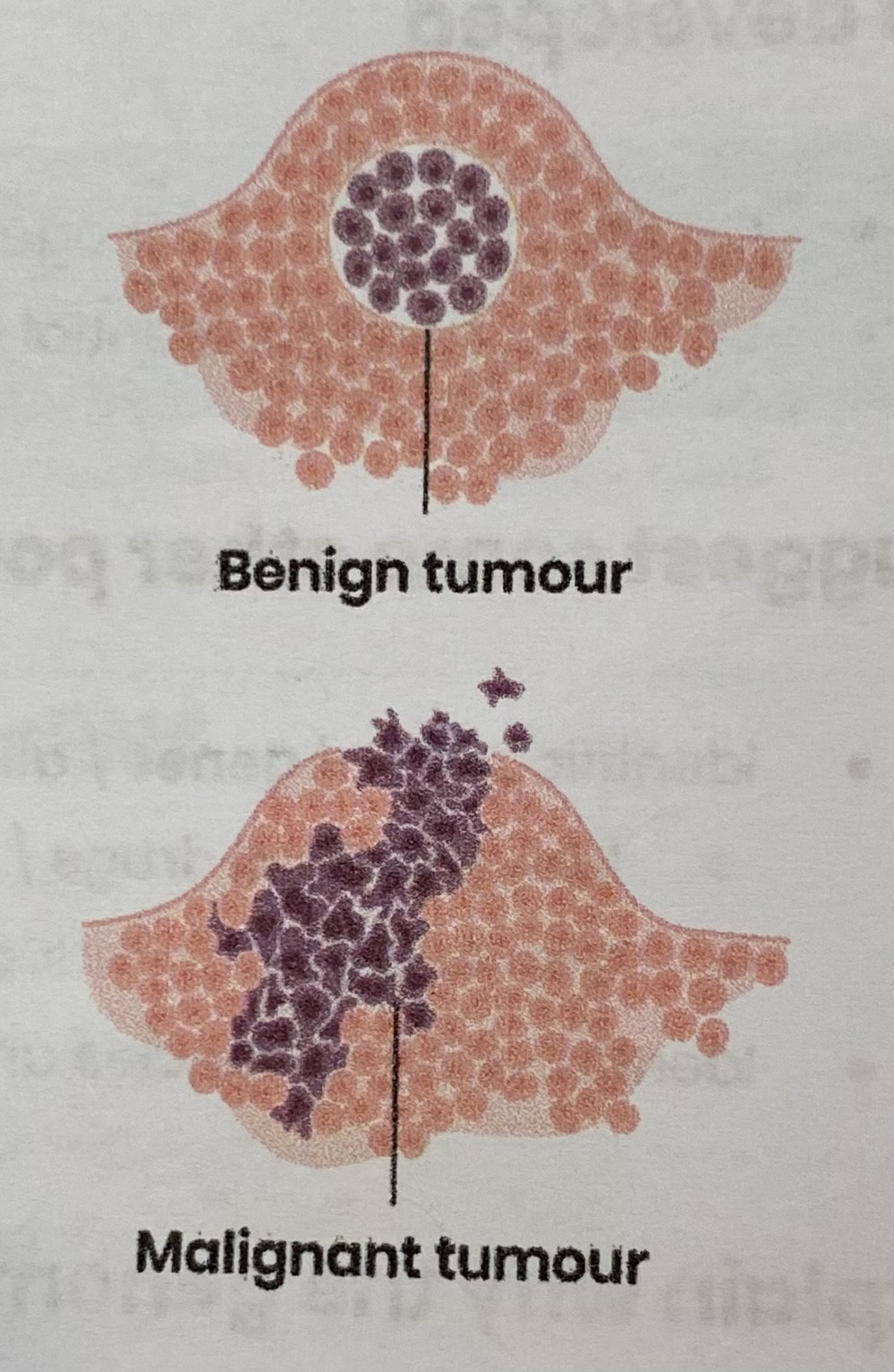 <ul><li><p>Mutations in DNA/ genes <strong>controlling mitosis</strong> can lead to <strong>uncontrolled cell division</strong></p></li><li><p><strong>Tumour </strong>formed if this results in <strong>mass of abnormal cells </strong></p><ul><li><p><strong>Malignant</strong> tumour= <strong>cancerous</strong>, can <strong>spread</strong> by <strong>metastatsis</strong></p></li><li><p><strong>Benign</strong> tumour= <strong>non-cancerous</strong></p></li></ul></li></ul><p></p>