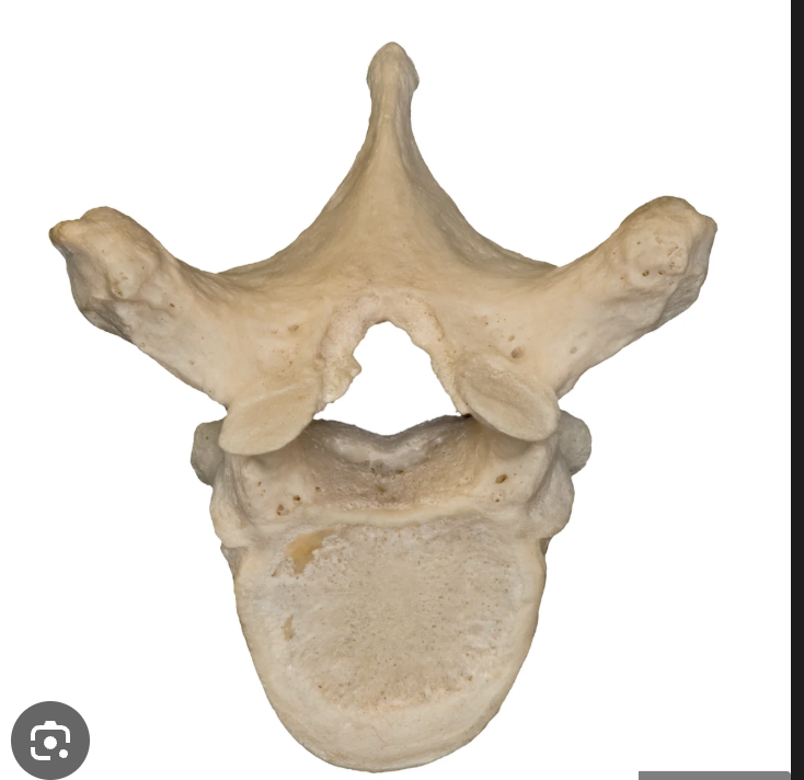 <p>what vertebrae is this? </p>