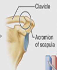 <p>Name the type of joint</p>