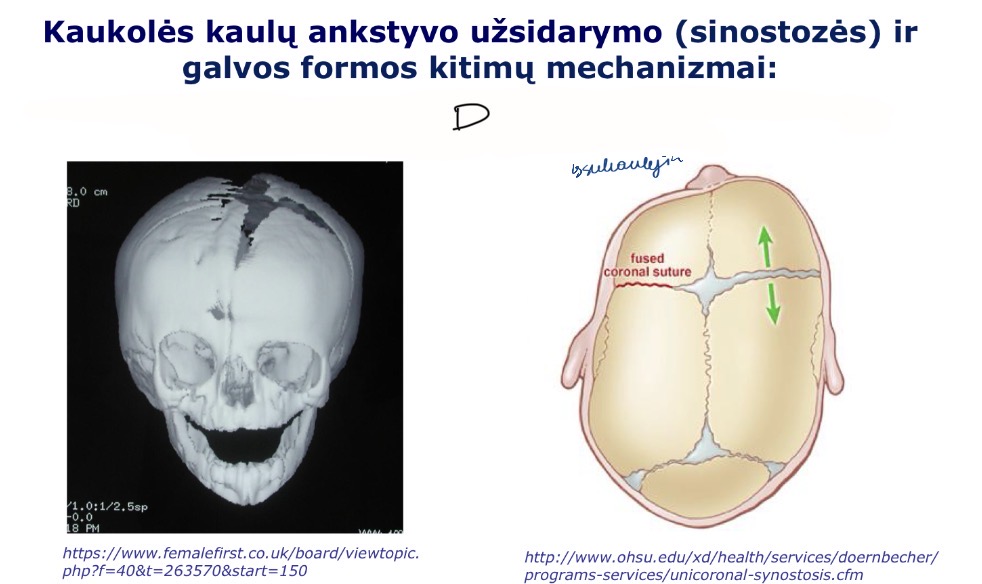 <p>D</p>