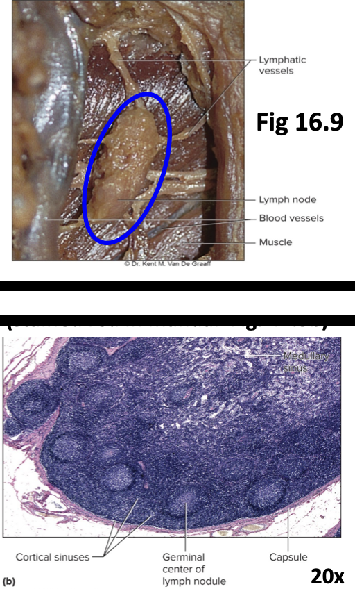 <p>lymphatic organ</p>